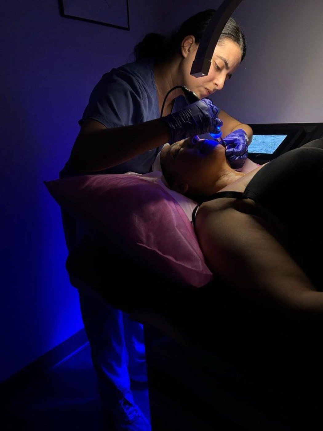 A Morpheus8 treatment in progress at the MedSpa
